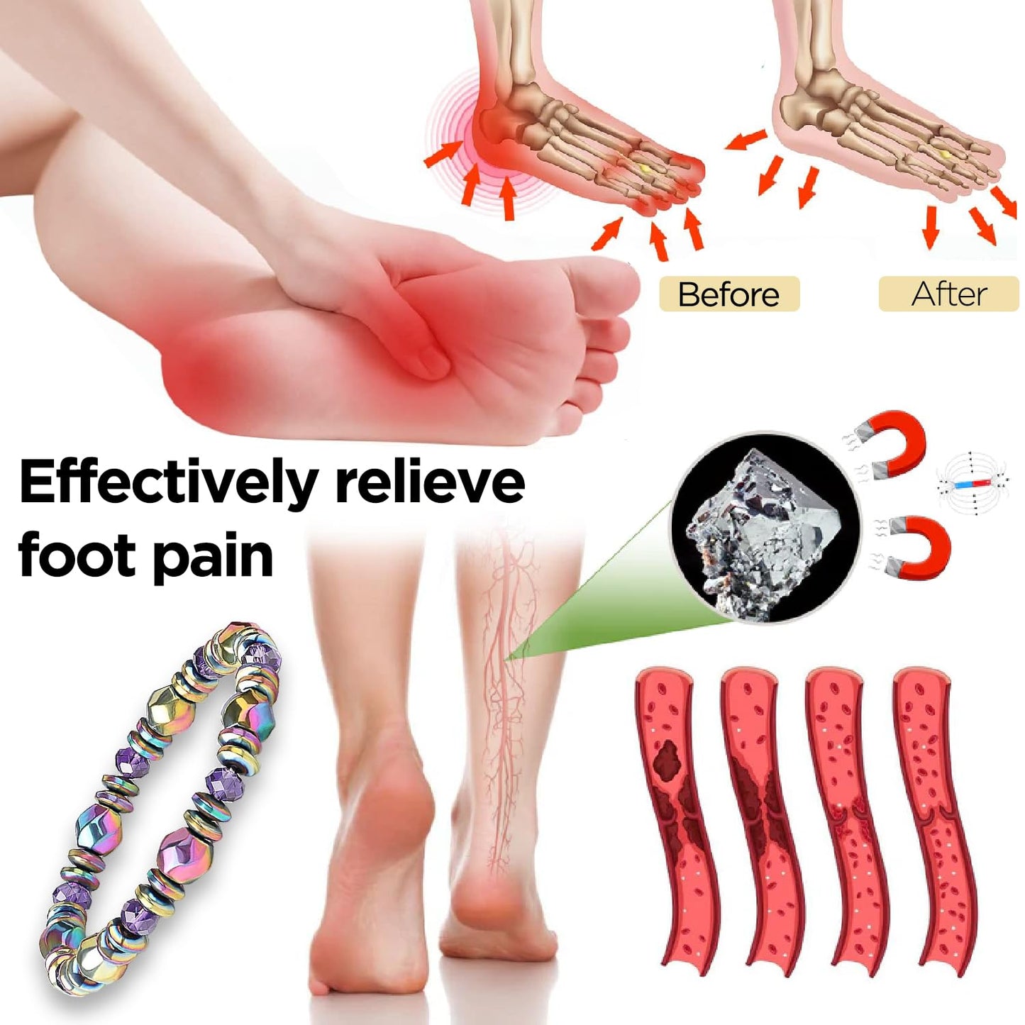 Magnetic Healing Bracelet – Adjustable Hematite Bracelet for Lymph Drainage, Arthritis, Anxiety Relief, Swelling Reduction & Weight Loss – Slimming Bracelet for Women & Men